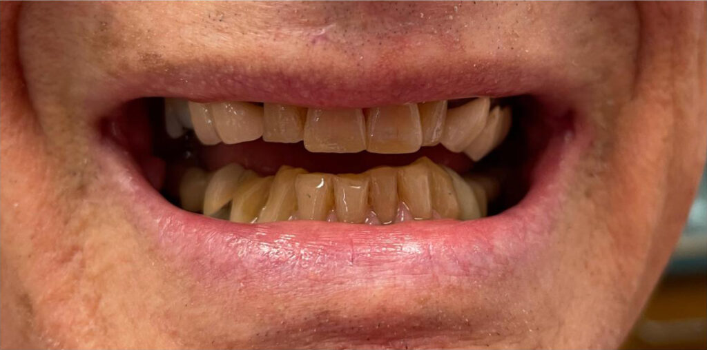 Dr. Dania A. Pellerano: DMM Family Dental Care, LLC