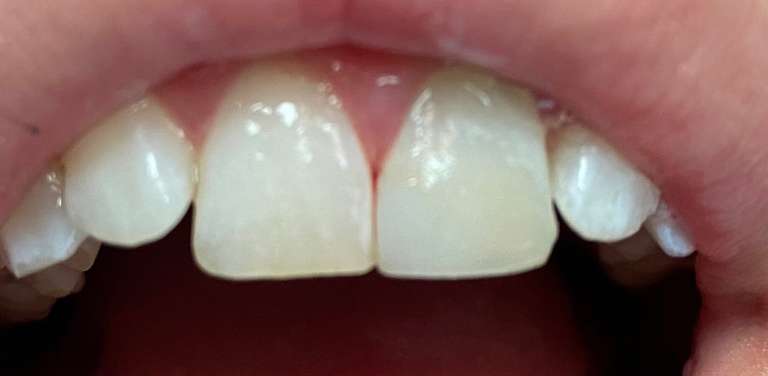 Dr. Dania A. Pellerano: DMM Family Dental Care, LLC