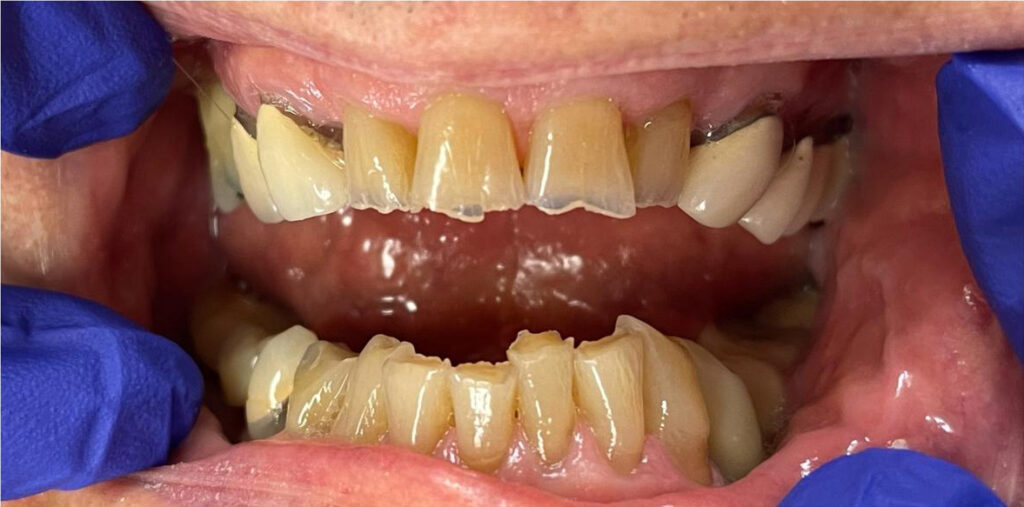 Dr. Dania A. Pellerano: DMM Family Dental Care, LLC