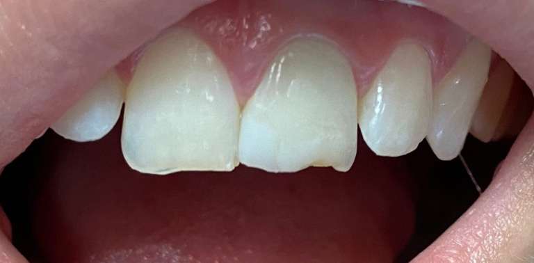 Dr. Dania A. Pellerano: DMM Family Dental Care, LLC